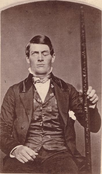 Image of Phineas Gage
