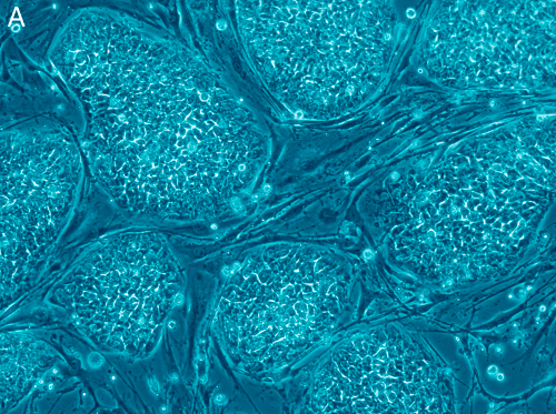 Human embryonic stem cells. Image credit: Nissim Benvenisty via Wikicommons 