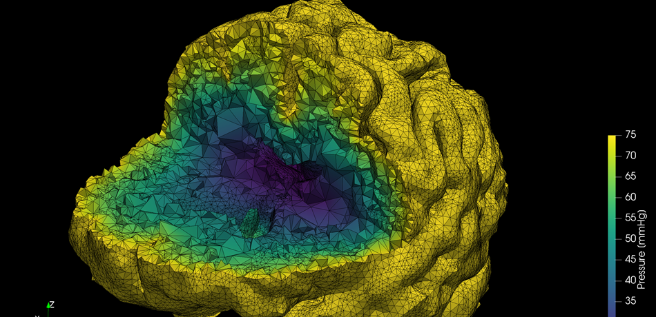 Computer model of the brain